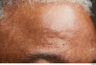 HD Face Skin Everson Baker face forehead skin pores skin…